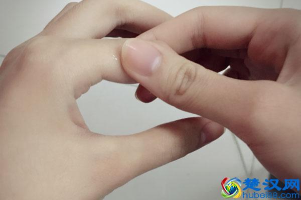 手指脱皮是怎么回事？