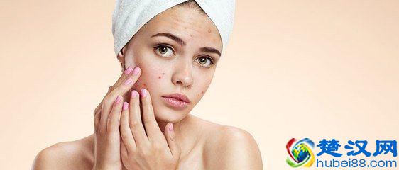 下巴老是长痘痘怎么回事？教你从源头祛痘！