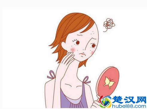 下巴老是长痘痘怎么回事？教你从源头祛痘！