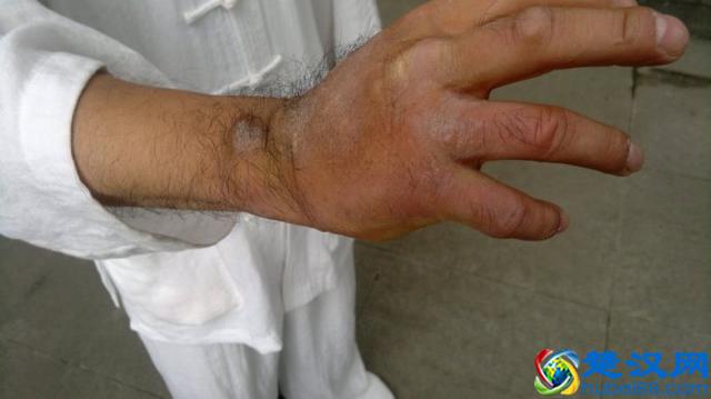 铁砂掌的分类铁砂掌怎么练