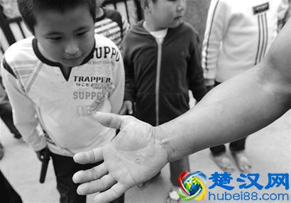 铁砂掌的分类铁砂掌怎么练