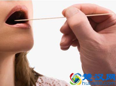 咽喉不舒服，干痒咳嗽，有下面这些症状的，不是咽炎，可能是它