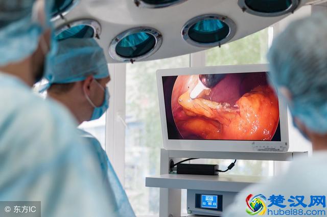 做胃镜时是选择无痛胃镜还是普通胃镜，听听消化科医生的建议！