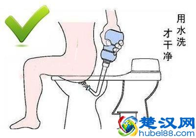 痔疮的最佳防治方法，一般人我不告诉他（建议收藏）