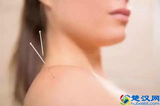 淋巴瘤即是淋巴癌！身体出现这3个症状，是淋巴瘤早期信号