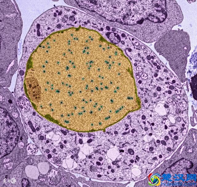 鼻咽癌早期有这5大症状，快看看你有没有！