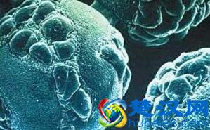 带状疱疹会传染人吗？导致带状疱疹发作的原因是什么？