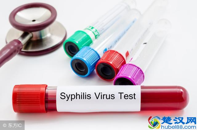 这些症状可能是梅毒上身的暗示,最好早点去检查