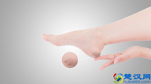 提醒：脚后跟经常痛，预示3大疾病风险！别太晚知道了