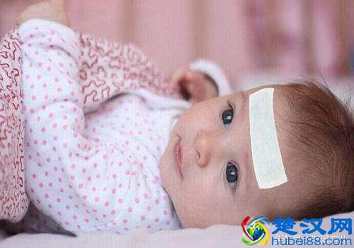 小孩高烧不退怎么办?轻松几步教您护理孩子高烧不退的方法