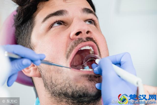 怎么去除牙齿上的“牙结石”？有用的方法有4个，别记错了