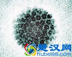 HPV病毒阳性是什么意思？了解宫颈癌的一级预防