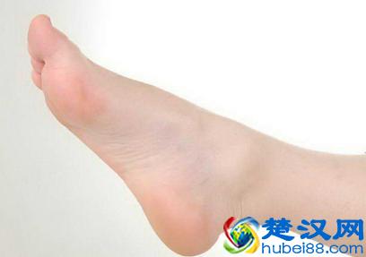 建议收藏：冬天脚出汗是什么原因？脚爱出汗怎么办？