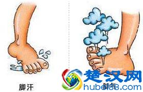 建议收藏：冬天脚出汗是什么原因？脚爱出汗怎么办？