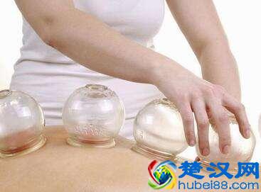 别随便拔罐，拔罐也是有坏处的！