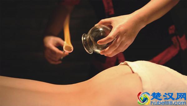 别随便拔罐，拔罐也是有坏处的！