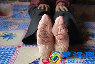 历史上中国女人裹小脚是从什么时候开始的？“三寸金莲”的来历