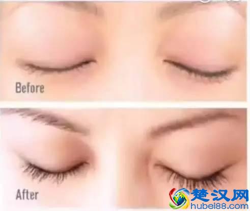 万能的凡士林，堪称护肤界的扛把子