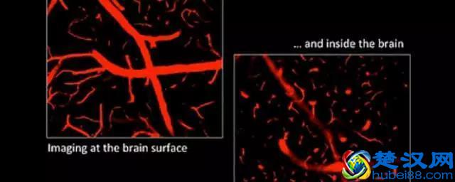 人为什么一定要睡觉？有一个很牛逼的原因