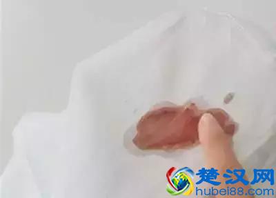 衣服不管染上什么，用这招都能洗掉，太实用了！