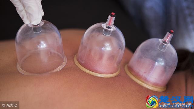 拔罐对身体有哪些好处？拔罐后的水珠和颜色变化代表什么？