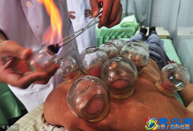 拔罐对身体有哪些好处？拔罐后的水珠和颜色变化代表什么？