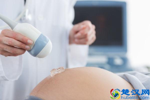 四维彩超和三维彩超有什么区别 四维彩超什么时候做最好？