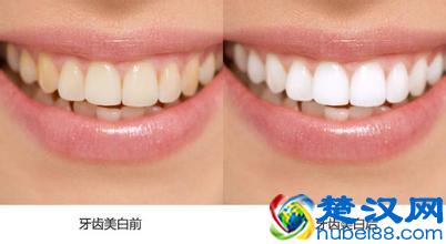 美白牙膏真的能美白么?我们测评了10款美白牙膏,结果