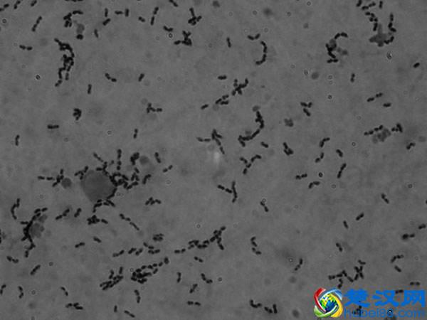 猪链球菌感染应该怎么治