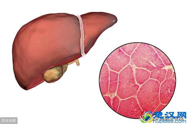 肝囊肿是怎么形成的？一般有这几种情况