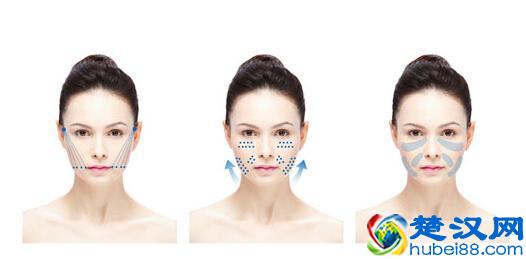 女人！眼角纹的这些事，你肯定不知道