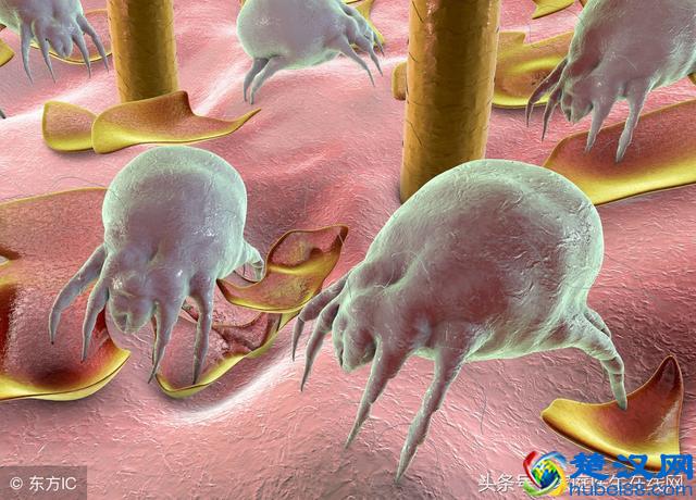 怎么去掉脸上的螨虫？记住2个“天然除螨法”，把螨虫一点点扼杀