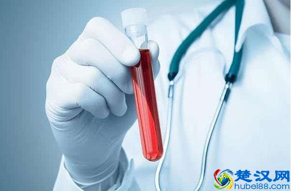 如何判断自己属于碱性体质，快速调理碱性体质生男孩