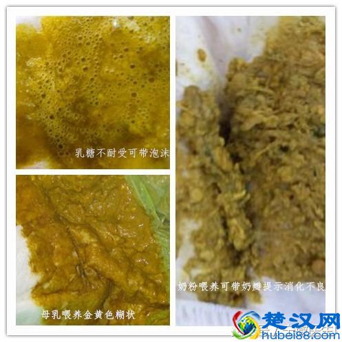 宝宝腹泻怎么办？如何判断宝宝是否腹泻？