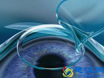 近视了怎么办？这里有3种提高裸眼视力的科学方法