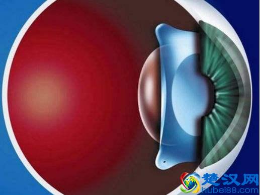 近视了怎么办？这里有3种提高裸眼视力的科学方法