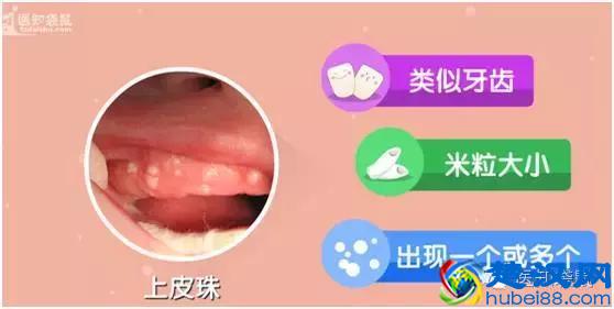 宝宝几个月长牙算正常？口腔专家给出了标准答案