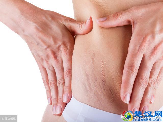 一般什么时候会长妊娠纹？到了这个月份，要做好预防措施