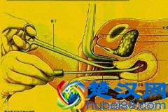 女性意外怀孕后，把握好做人流的最佳时间可以减小对身体的伤害！