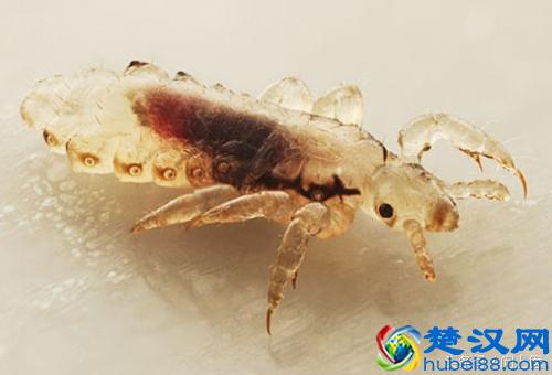 注意,这些寄生虫可能在你的身上,你却不知道!