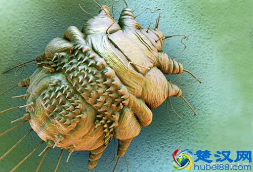 注意,这些寄生虫可能在你的身上,你却不知道!