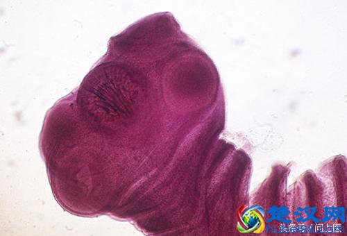 注意,这些寄生虫可能在你的身上,你却不知道!