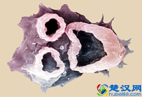 注意,这些寄生虫可能在你的身上,你却不知道!