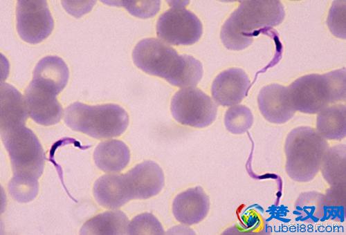 注意,这些寄生虫可能在你的身上,你却不知道!