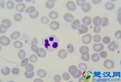 注意,这些寄生虫可能在你的身上,你却不知道!