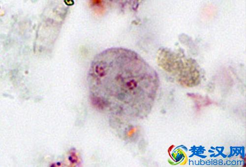 注意,这些寄生虫可能在你的身上,你却不知道!