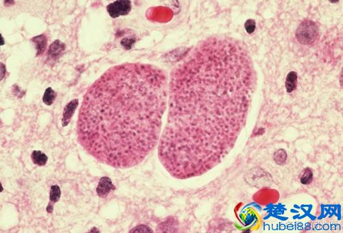 注意,这些寄生虫可能在你的身上,你却不知道!