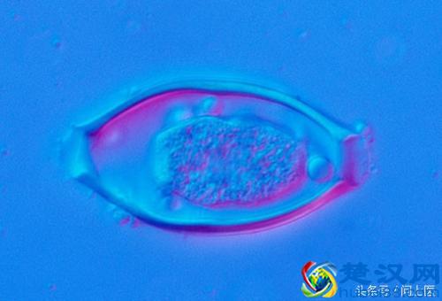 注意,这些寄生虫可能在你的身上,你却不知道!