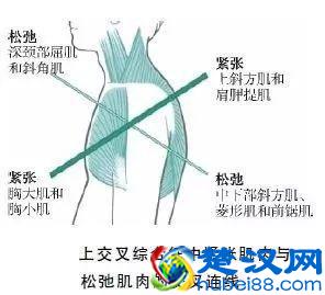 背背佳帮你改善圆肩驼背？错了，重点在改善肌肉状态
