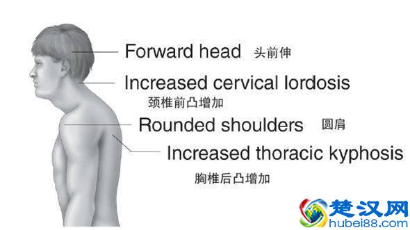 背背佳帮你改善圆肩驼背？错了，重点在改善肌肉状态